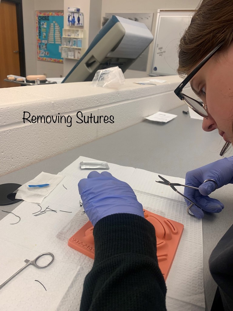 removing sutures